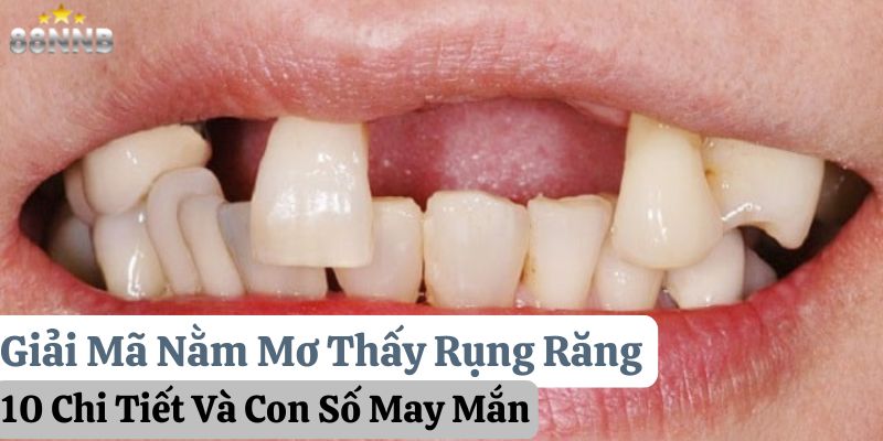 nằm mơ thấy rụng răng 88nn thumb