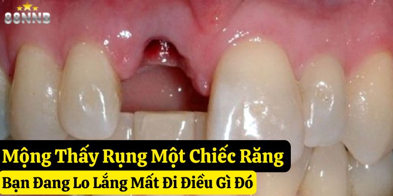 nằm mơ thấy rụng răng 88nn