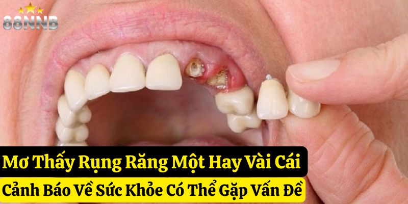 nằm mơ thấy rụng răng tốt hay xấu 88nn