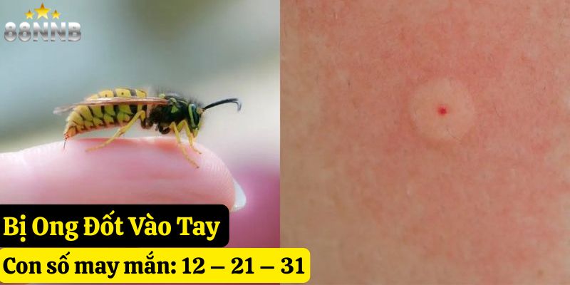 tự nhiên bị ong đốt đánh con gì 88nn