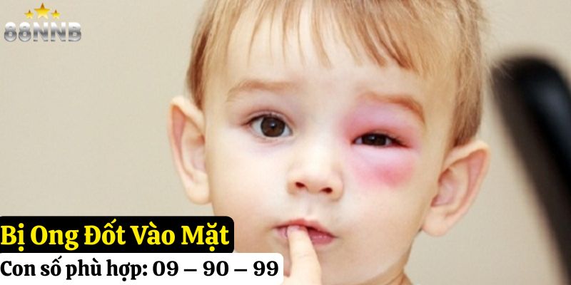 tự nhiên bị ong đốt đánh con gì